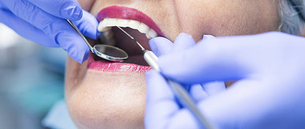 Best Broken Tooth Emergency  in Monticello, UT